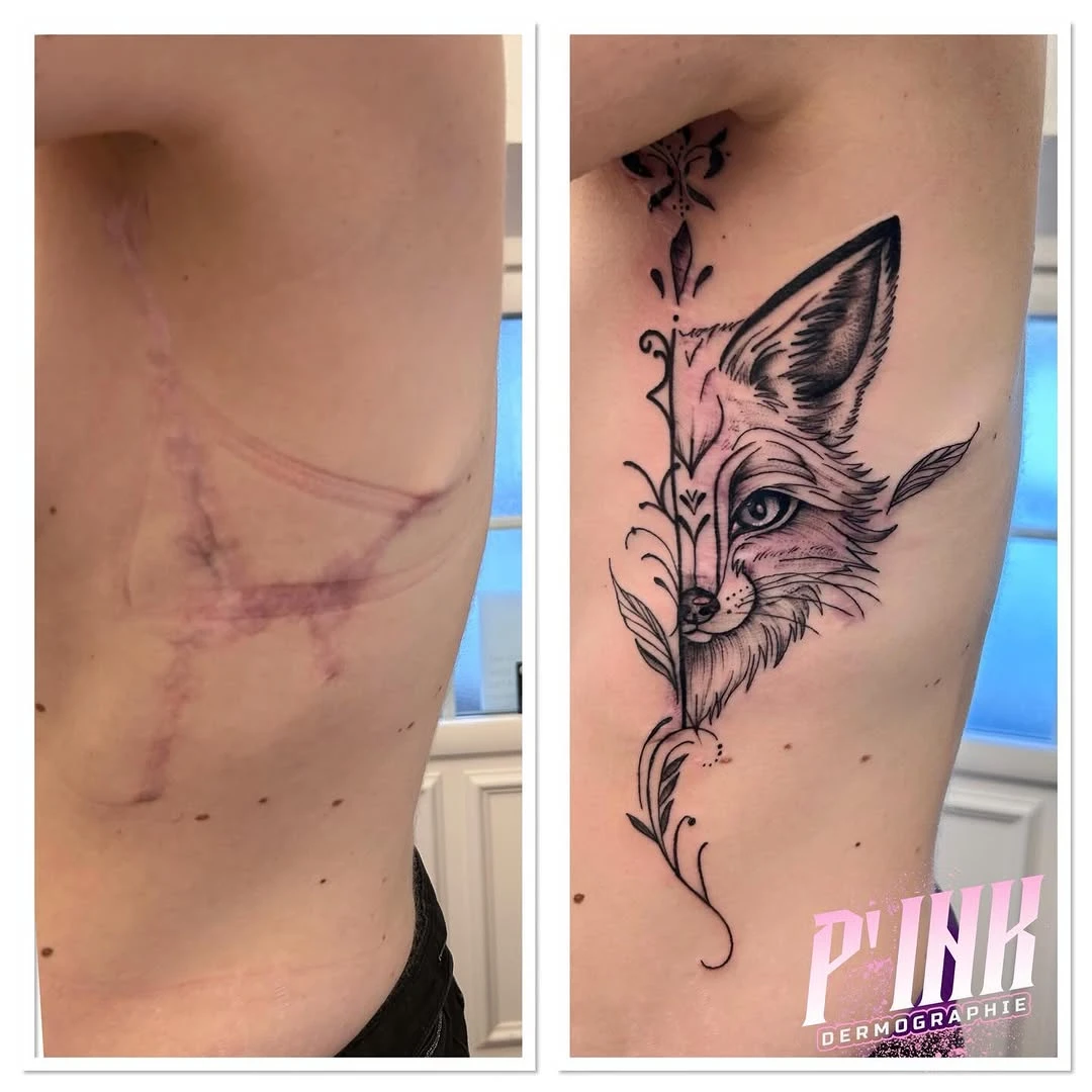 Travail de Pink Dermographie